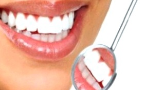 Лечение зубов в рассрочку нижний новгород