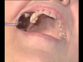 Лечение зубов в нижнем новгороде цены
