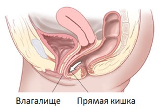 13 Городская больница нижний новгород урологическое отделение